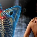 Qué es la fibromialgia: causas, síntomas y tratamientos