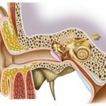 ¿Qué es la otitis y cómo tratarla?