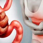 Estreñimiento en adultos mayores