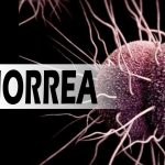 ¿Qué es la gonorrea? causas, síntomas, prevención, tipos, diagnóstico y tratamientos