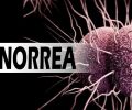 ¿Qué es la gonorrea? causas, síntomas, prevención, tipos, diagnóstico y tratamientos