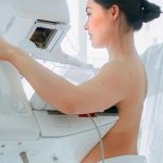 Mamografía: Las 7 preguntas clave
