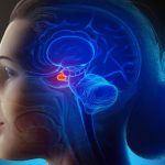¿Qué es la acromegalia?