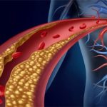 El impacto del colesterol en los jóvenes de hoy y cómo prevenirlo